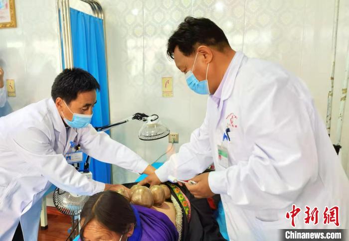 圖為看照加手把手帶徒弟加老(左一)進行拔罐療法?！堟?攝